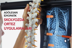 OPODERGİ